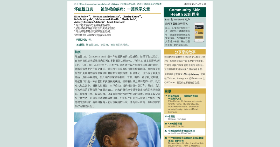 community-skin-health-journal-vol-17-2-simplified-chinese-ilds