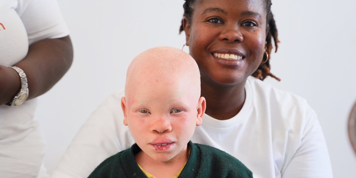A young child with albinism looks at the camera, she is sitting on the knee of a woman who is smiling at the camera