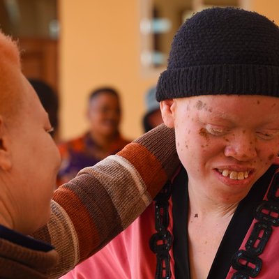 Two people with Albanism are in frame. One of them is looking at the other, we can see only the back and side of their head, and the other is smiling and looking down towards the floor, they are wearing a dark beanie hat.
