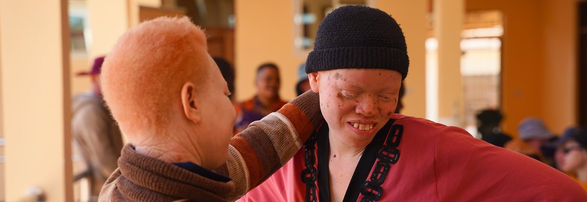 Two people with albinism are in frame. One of them is looking at the other, we can see only the back and side of their head, and the other is smiling and looking down towards the floor, they are wearing a dark beanie hat.