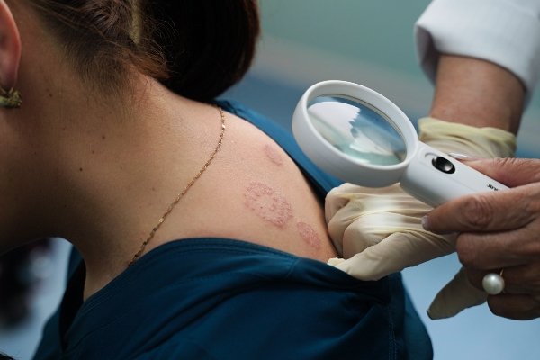 Woman with skin condition being examined by a doctor