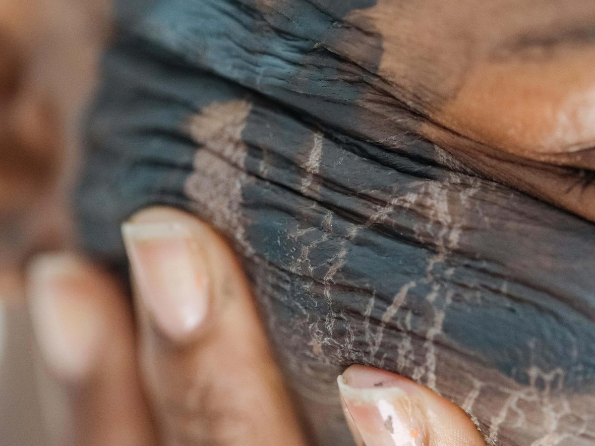 A close up of a person's face who has applied something to her face and it is cracking on her skin